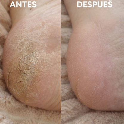 Lima de vidrio para pies Chekiglu